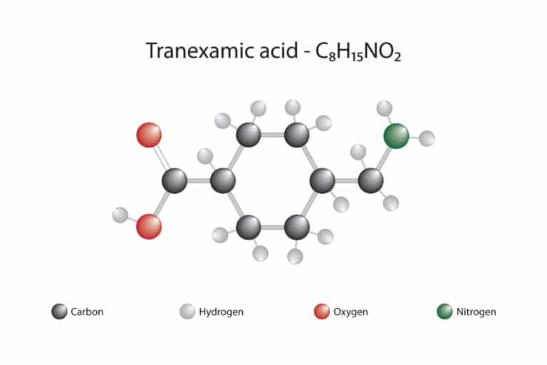 AMCHA, TXA, Tranexamic Acid